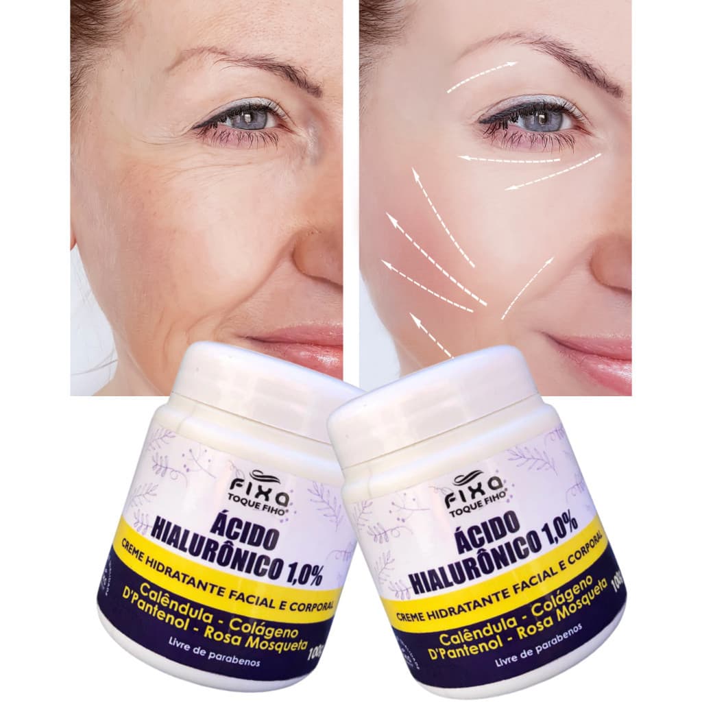 Creme Ácido Hialurônico Anti Rugas Colágeno E Rosa Mosqueta100g Hidratante Facial Reduz Linhas De Expressão